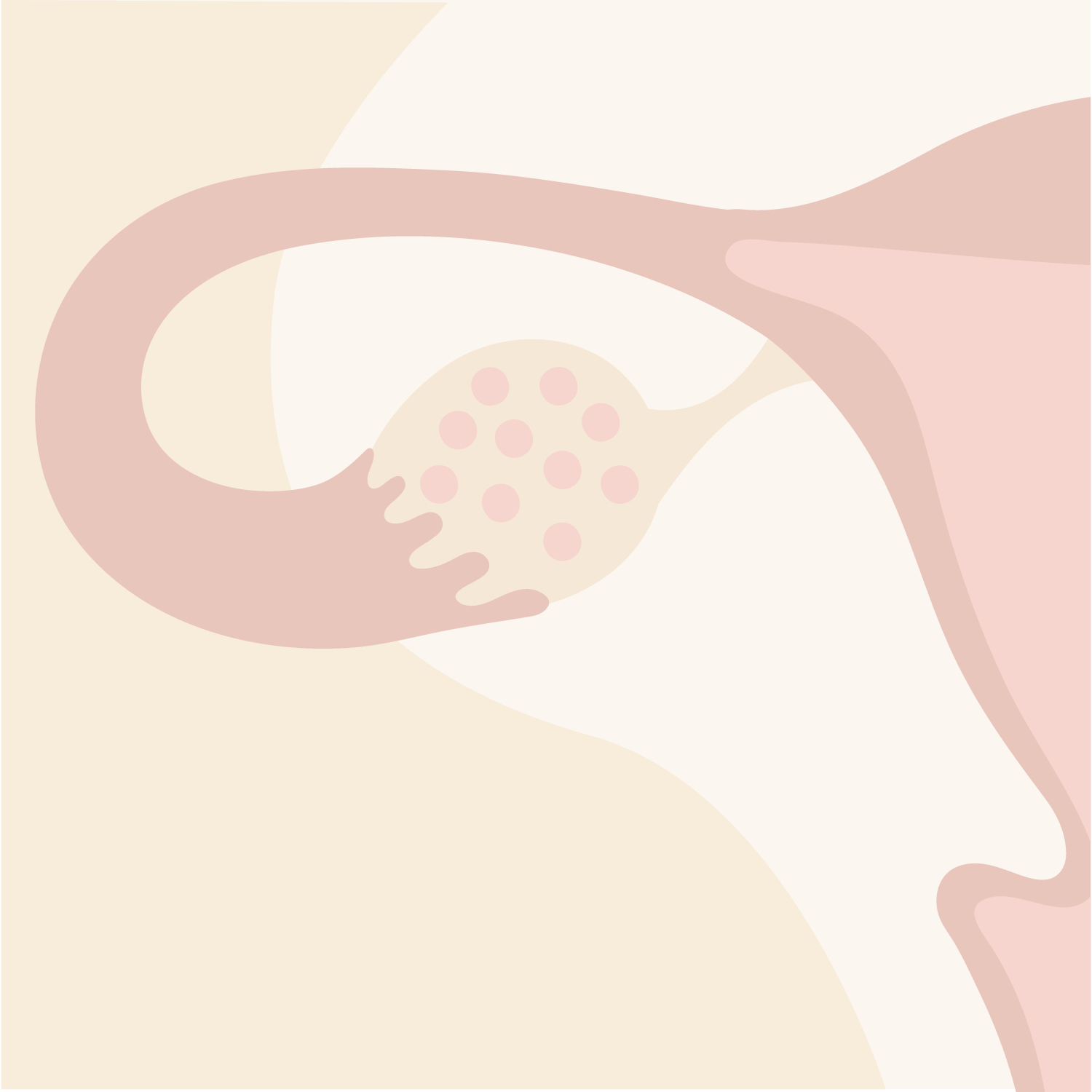 UNDERSTANDING PCOS UNDERSTANDING PCOS